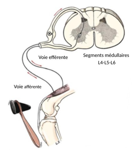 Figure 2 : La chirurgie est réalisée par une incision de 1 cm sous contrôle de l'amplificateur de brillance. Les chirurgiens sont équipés de matériel de radioprotection